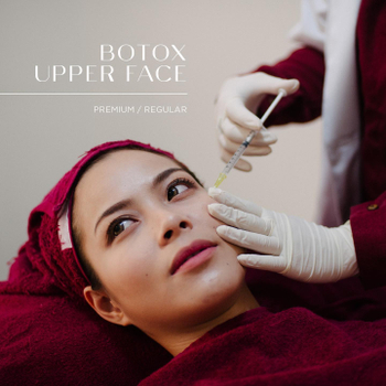 botox Upper Face